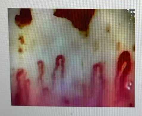 图源：邵逸夫医院风湿免疫科